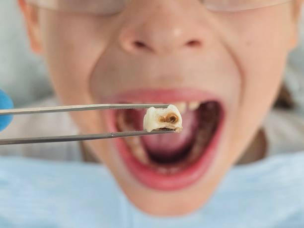 Best Tooth Infection Emergency Dentist  in Rayville, LA